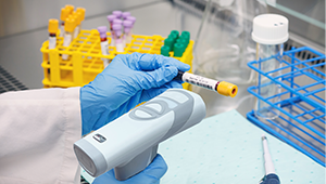 Sample ID Automation Sample ID Automation